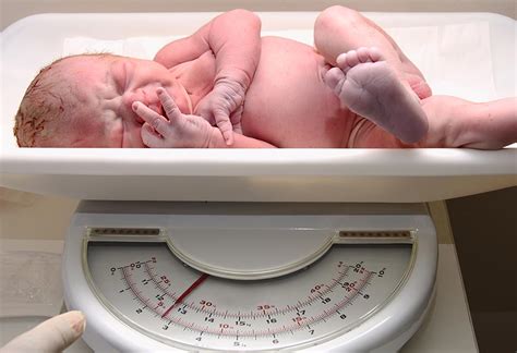 Normal Weight Loss for a Newborn in the Initial Days After Birth