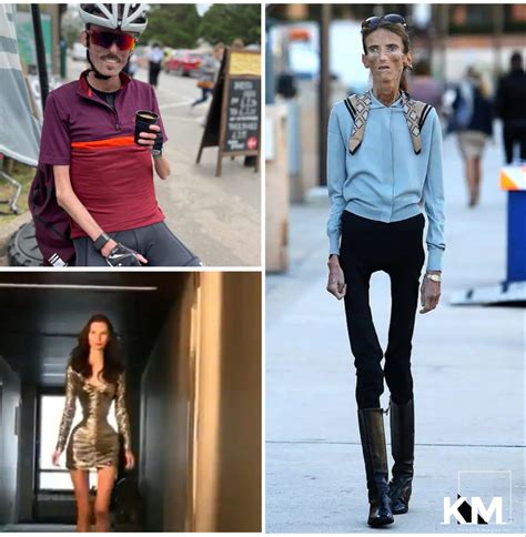 Top 10 Skinniest People In The World 2022 - Kenyan Magazine