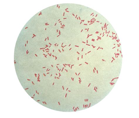 Public Domain Picture | A photomicrograph of Pseudomonas aeruginosa ...