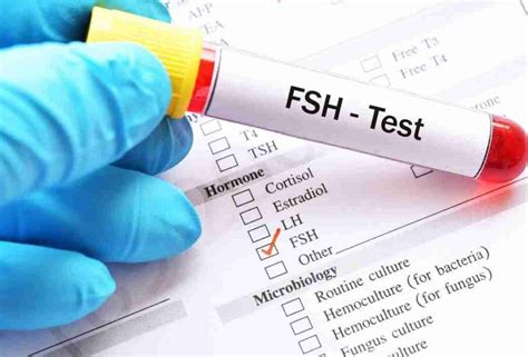 FSH Blood Test and Understanding the Results