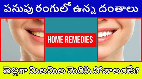 Yellow Teeth : పసుపు రంగులో దంతాలు.. తెల్లగా మార్చేందుకు ఇంటి నివారణ ...