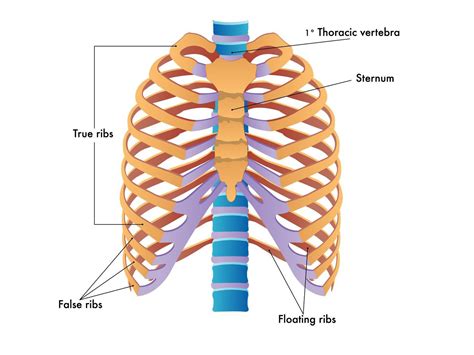 Slipping rib syndrome is a painful and rare disorder also known as ...