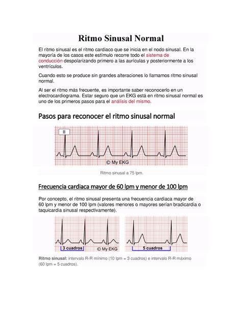 Ritmo Sinusal Normal - En la mayoría de los casos este estímulo recorre ...