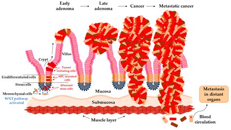 Villous Adenoma Vs Tubular Adenoma