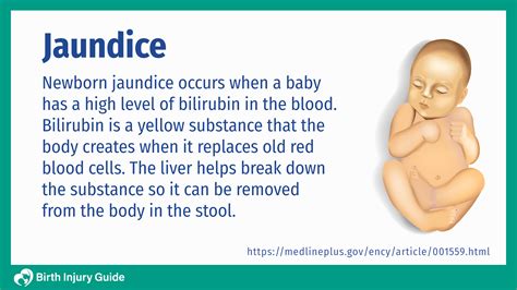 Newborn Jaundice | Birth Injury Guide