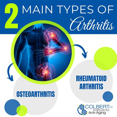 The-Two-Main-Types-Of-Arthritis - Colbert Institute of Anti Aging