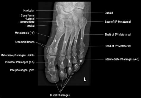 X-Ray Positioning Guide: Toes | Medical Professionals