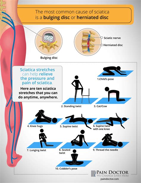 Printable Exercises For Sciatica Pain Pdf