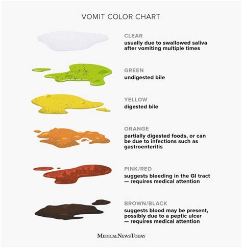 Vomit color chart: Clear, white, green, yellow, orange, red, and more ...