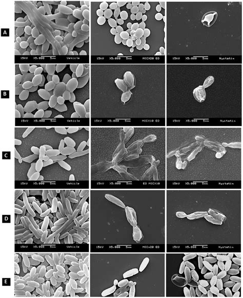 Effects on biofilm morphology. SEM Photomicrographs (5,000x) showing ...