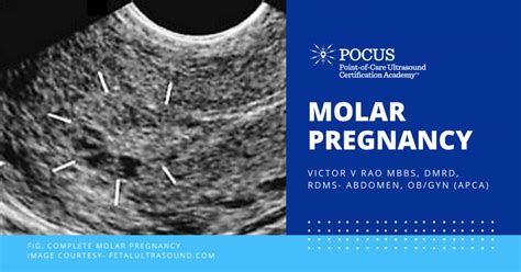 Molar Pregnancy | Point-of-Care Ultrasound Certification Academy