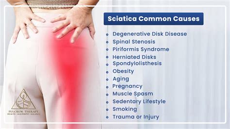 Sciatica: All You Should Know About Sciatic Nerve Pain