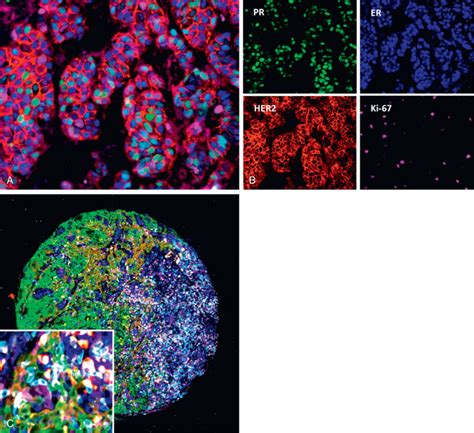 Techniques of Immunohistochemistry: Principles, Pitfalls, and ...