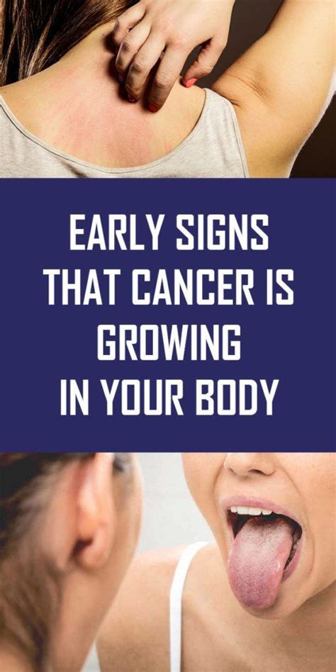 Early Warning Signs Cancer Is Growing Inside Your Body - natural