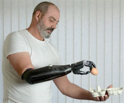 The Future Is Now: The Real Life Cyborgs Among Us Today