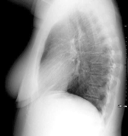 Chest Radiology