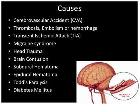 Hemiplegia (1)