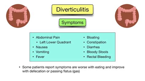 Diverticular Disease: Diverticulitis vs Diverticulosis - Symptoms, Diet ...