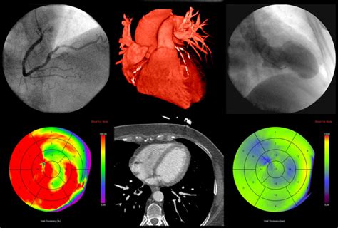 Imaging explained