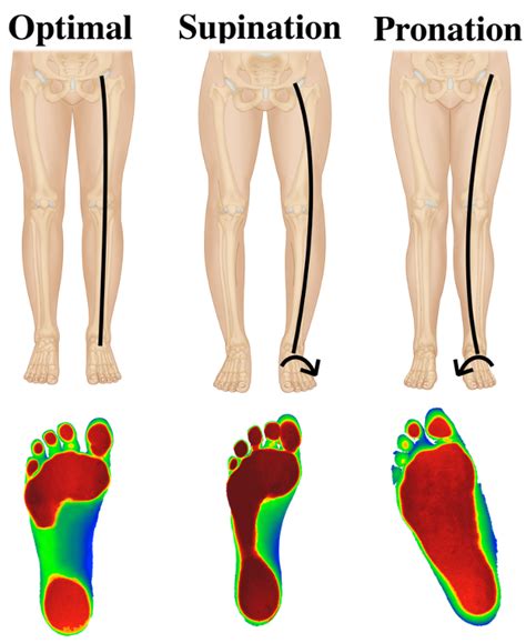 Supination Of Ankle