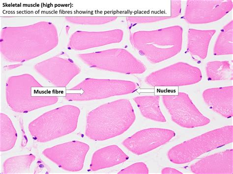 Skeletal Muscle – Normal Histology – NUS Pathweb :: NUS Pathweb