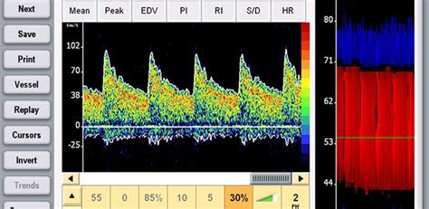 Dolphin IQ — Image Monitoring Inc