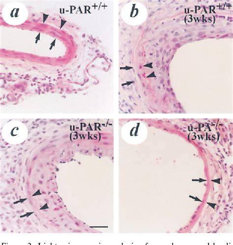 Figure 2 from Receptor-independent Role of Urokinase-Type Plasminogen ...