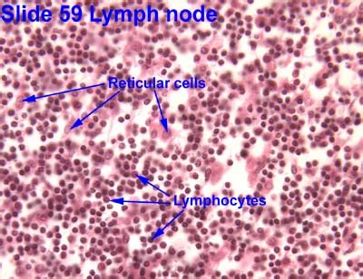 Reticular Connective Tissue Lymph Node