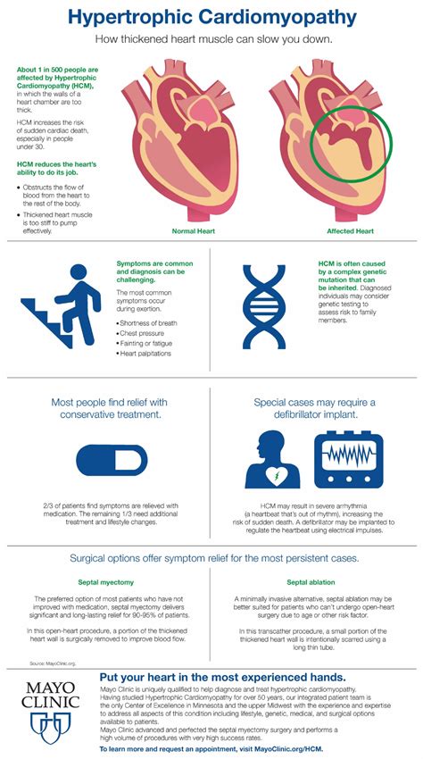 Infographic: Hypertrophic Cardiomyopathy – Mayo Clinic News Network ...