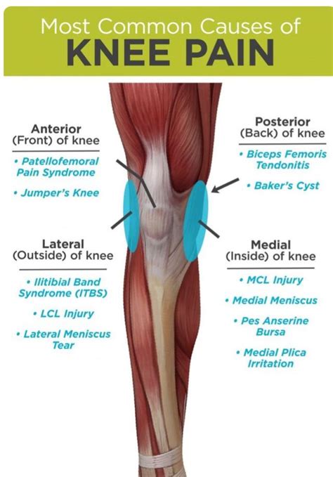 Exercises To Avoid With Mcl Injury - Exercise Poster