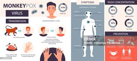 Infografis Cacar Monyet Infeksi Gejala Pencegahan Penyakit Cacar Monyet ...