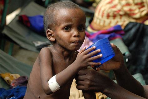 Malnutrition: global pandemic affects one third of world’s population ...