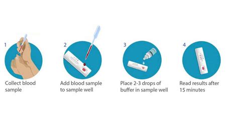 BD, BioMedomics Announce Launch of Rapid Serology Test to Detect ...