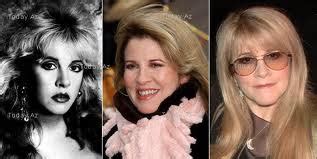 Stevie Nicks Plastic Surgery Before and After Botox Injections and Eyebrow