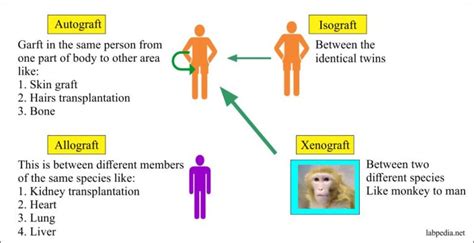 Chapter 15: Transplantation and Rejection Phenomenon - Labpedia.net