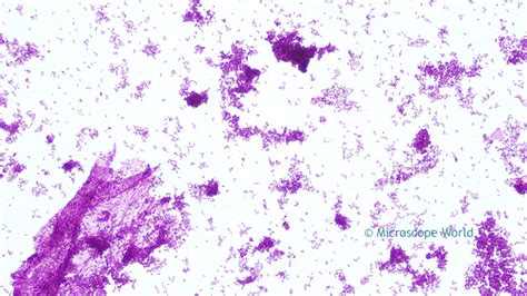 Microscope World Blog: Diphtheria under the Microscope