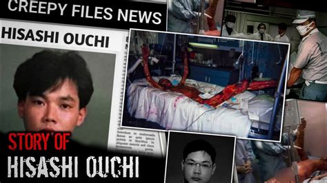 Understanding The Impact And Legacy Of Hisashi Ouchi's Hospital Experience