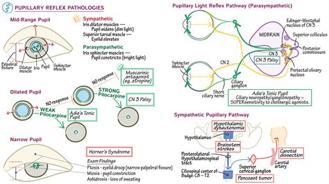 Pathology: Pupillary Reflex Pathologies | ditki medical & biological ...