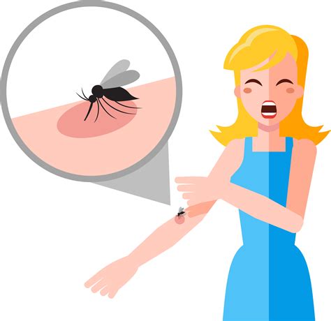 Falciparum malaria - mosquito bite Mosquito Bite, Malaria, Vector ...