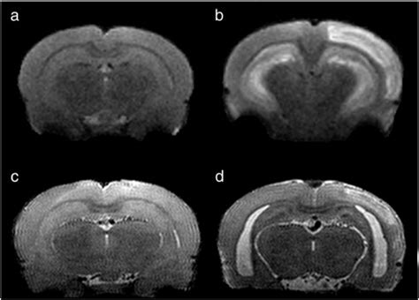 Coronal MRI images of the rat brain following status epilepticus ...