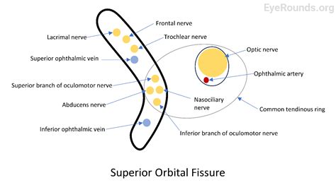 EyeRounds.org: Superior Orbital Fissure Syndrome