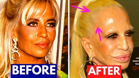 Raquel Welch Plastic Surgery Before And After Plastic