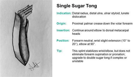 SplintER Series: Common ED Splint Techniques | Splint Principles 104