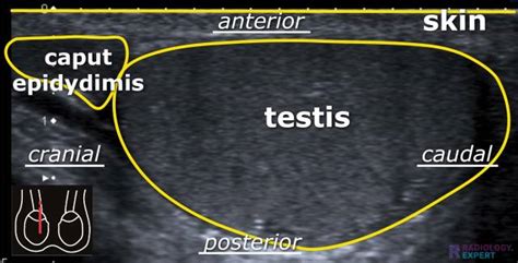 Scrotal ultrasound