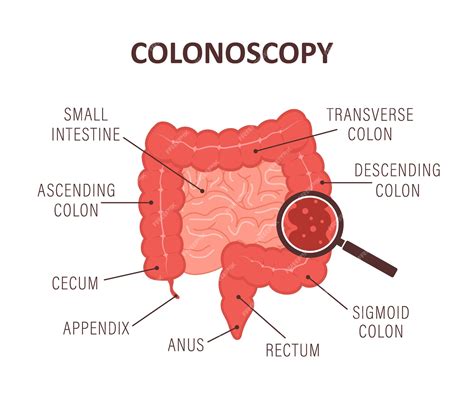 Premium Vector | Colonoscopy concept intestine exam and treatment bowel ...