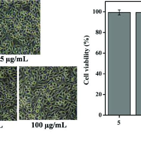 Cytotoxicity effect (morphology and viability) of different ...