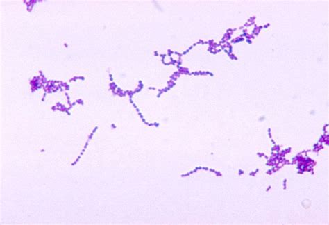 strep throat through a microscope