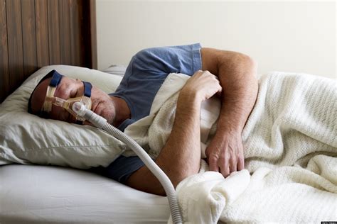 Sleep Apnea and VA Service-Connected Compensation