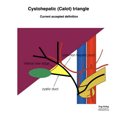 Image | Radiopaedia.org