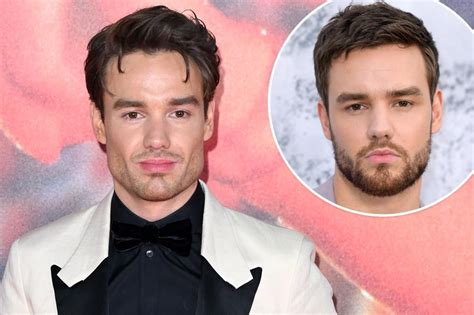 Cosmetic surgery experts weigh in on Liam Payne’s shocking new look in ...